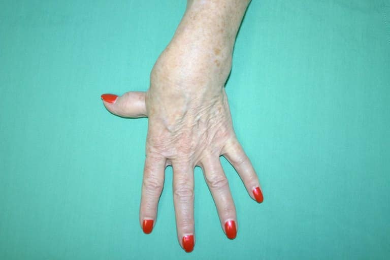 Older hand with red painted nails on a turquoise background
